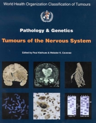 IARC Publications Website - WHO Classification of Tumours