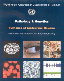 IARC Publications Website - Pathology and Genetics of