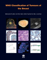 IARC Publications Website - WHO Classification of Tumours