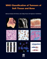 Who Classification of Tumours of Endocrine Organs (World Health Organization Classification of Tumours) [ペーパーバック] Lloyd， Ricardo V.、 Osamura， Robert Y.、 Kloppel， Gunter; Rosai， Juan World Health Organization Classification of Tumours of
